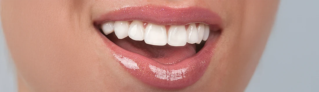 Dentist Canoga Park CA Full Mouth Reconstruction A close-up shows a person's mouth with glossy pink lips slightly parted, revealing bright, white upper teeth.